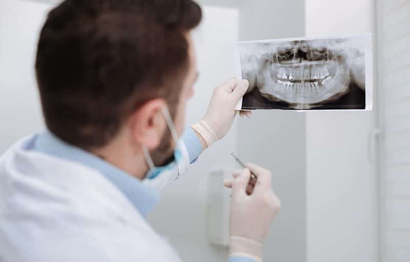 male dentist with beard analyzing dental x-ray